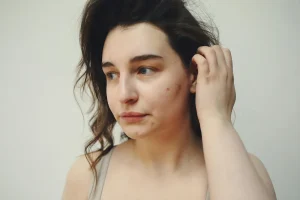How to Cover a Pimple With Makeup Like a Pro