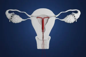 What to Expect with IUD Insertion: A Complete Guide to Intrauterine Devices (IUDs)