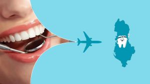 Why Thousands of Europeans Are Flying to Albania for Dental Work (And You Should Too)