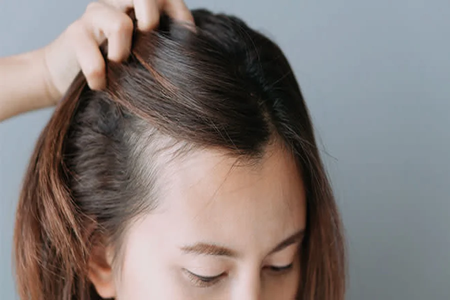 Post-Pregnancy Hair Fall: What to Expect 